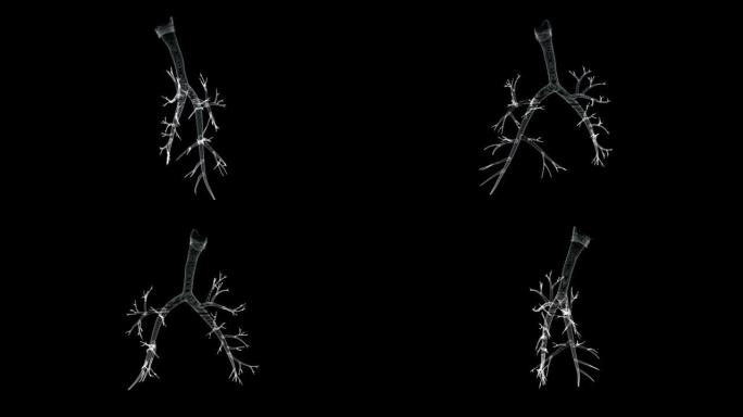 喉、气管、支气管环全息图