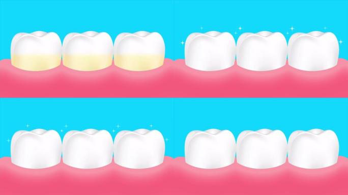 黄色到白色的牙齿。牙齿美白，牙齿护理理念。