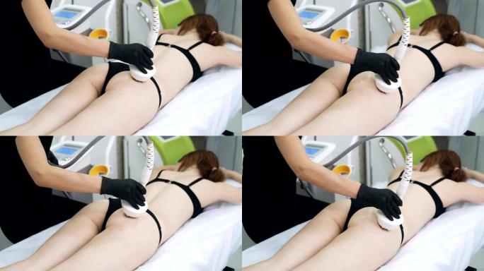 美容师对患者的臀部进行射频提升。慢动作