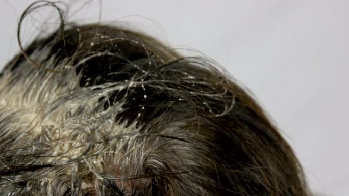 女性根部的白发，本身在家里用刷子染发