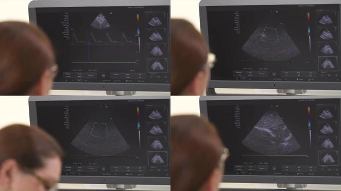 专业女医生做超声波检查的特写。腹部超声。监视器上的骨盆器官。医疗保健概念