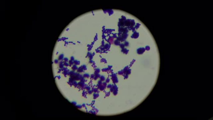 显微镜下的葡萄球菌。厌氧生物样本。实验室研究概念
