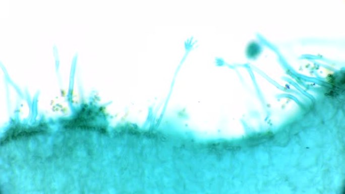 曲霉菌的显微观察