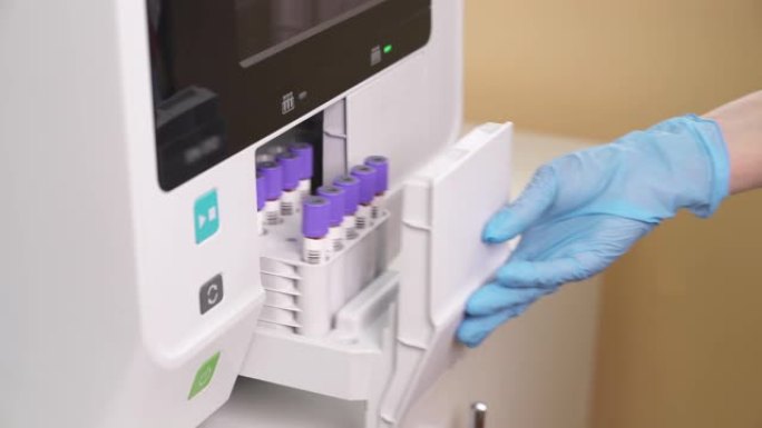 医疗技术人员关闭血液分析仪平台与血液样本的特写。生化血液检测