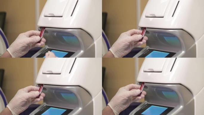 临床实验室科学家使用血液计数器进行血液测试的特写演示视频。现代专业实验室中的血液分析仪