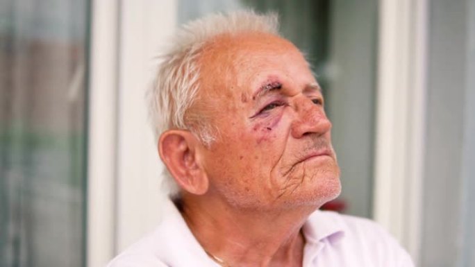 老年人肖像，眼睛受伤的白人老人盯着摄像机，慢动作