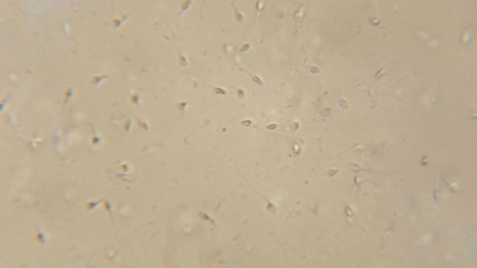 在显微镜下观察的精子。在相衬显微镜下移动的人类精子。特写显示精子。在显微镜下录像精液。4 k UHD