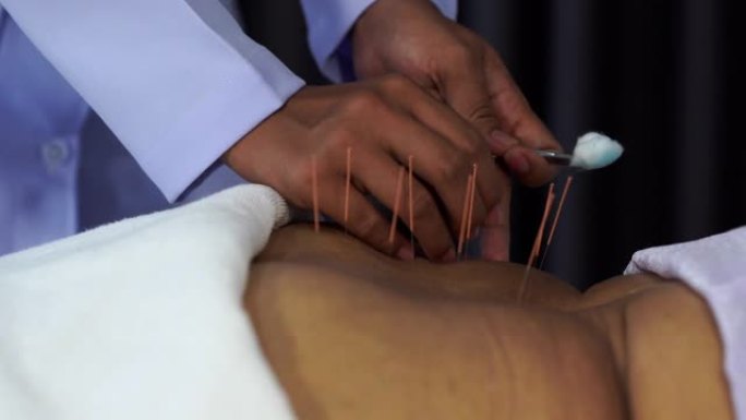 针灸治疗过程中使用钢针对高级女性背部进行特写