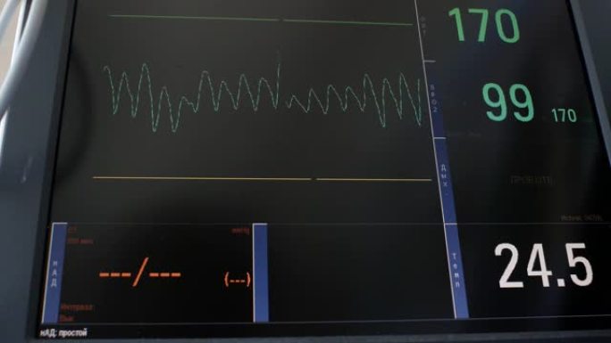 心电图的显示，病人心跳和血压的电活动图，心电图或心电图屏幕上的图表。婴儿heartbeat.4k。4