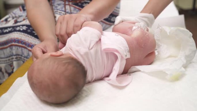 新生儿医生对婴儿髋关节进行超声检查的特写镜头。髋关节发育不良。儿科概念