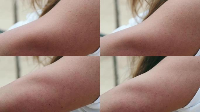 年轻女子上臂的皮肤