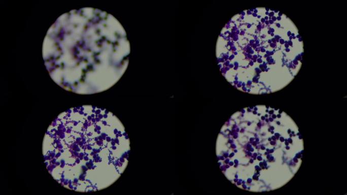 显微镜下的葡萄球菌。实验室研究概念。焦点变化镜头