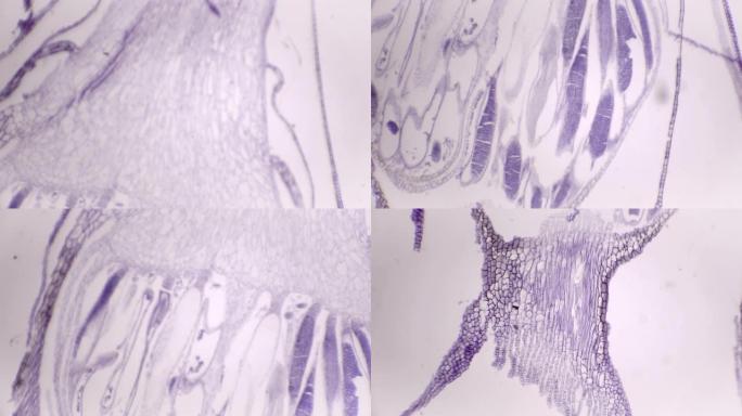 Polytrichum Archegonia (发帽苔藓) 的显微视图