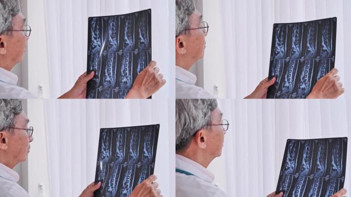亚洲资深男性医生正在全面分析x射线胶片的治疗效果。