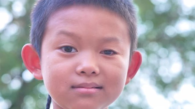 亚洲男孩的特写脸。左眼是看不见的残疾。慢动作