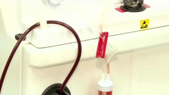 输血器具