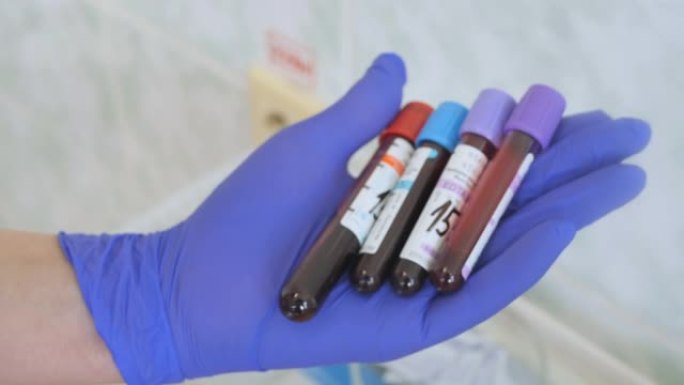 医疗机构的血液采样。