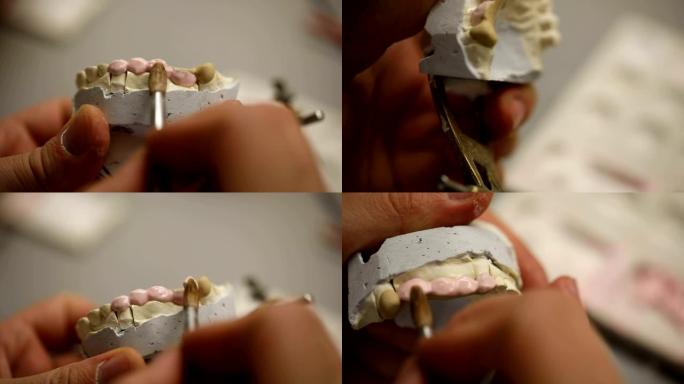 牙科技师工作石膏牙科助理正畸医生