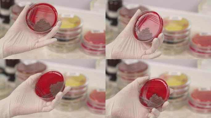 医学技术人员在微生物实验室手持培养皿的特写镜头。医学研究概念