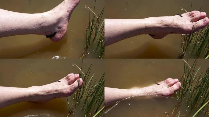 自然水蛭疗法，人们在湖里做水蛭疗法，