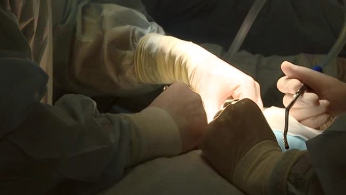 整形外科医生团队在急诊室在无菌制服上进行手术的人的脊柱，在脊柱中心。现代医学背景