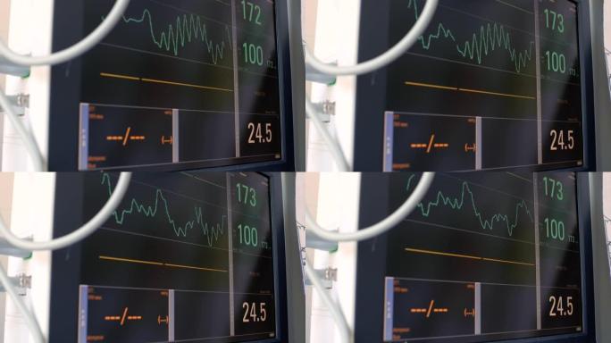 心电图的显示，病人心跳和血压的电活动图，心电图或心电图屏幕上的图表。婴儿heartbeat.4k。4