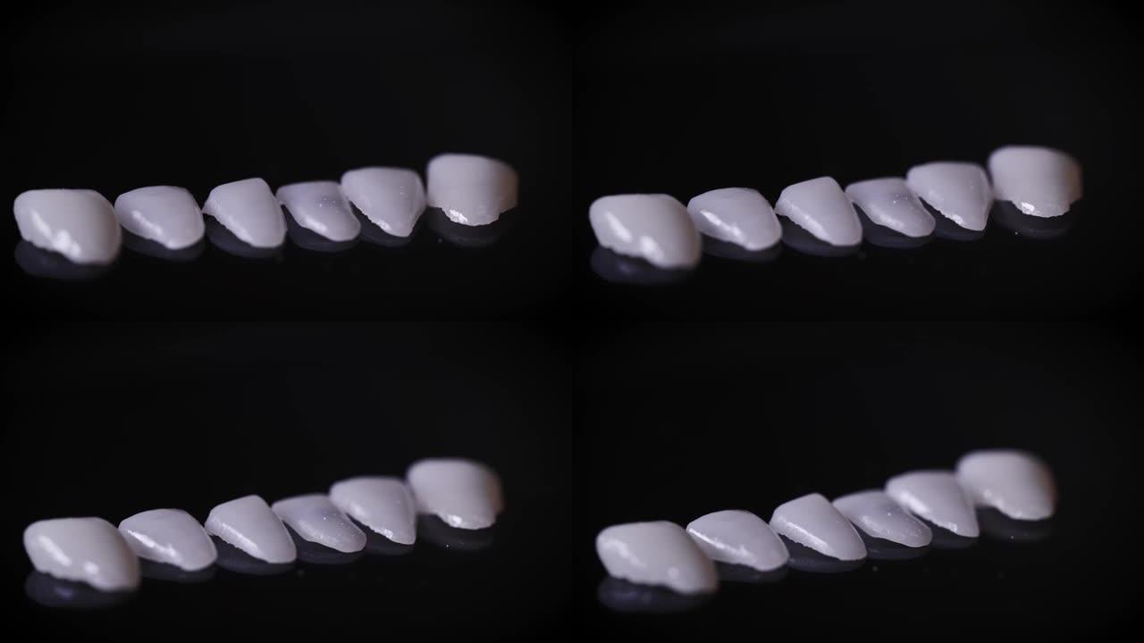 牙科贴面的宏观照片。贴面是具有美学功能的特殊牙垫。现代精密制造让您创造完美的微笑
