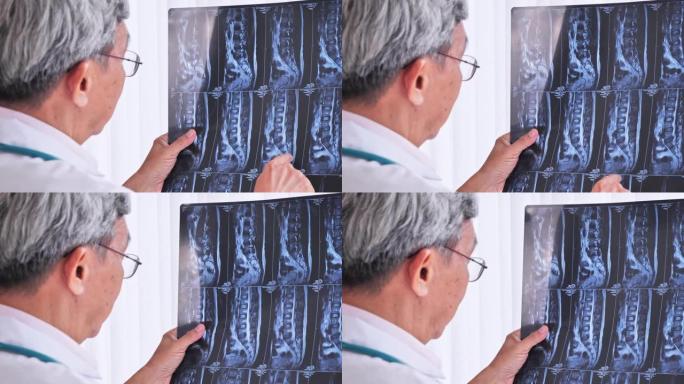 亚洲资深男性医生正在全面分析x射线胶片的治疗效果。
