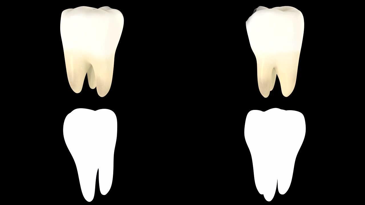 带有alpha层的蛀牙的3D动画