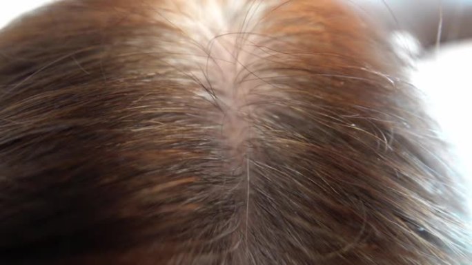 染发的头发的根部