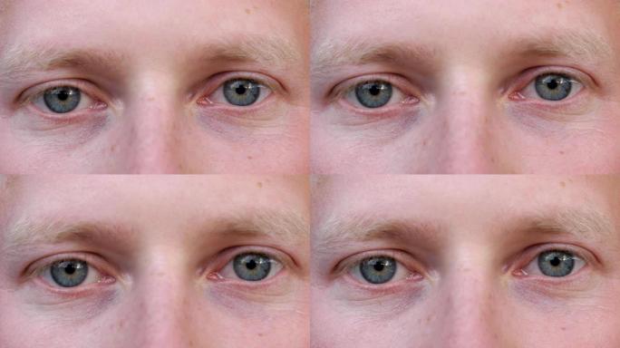 用疲惫的目光闭上男人凝视和眨眼的蓝眼睛。男性脸的肖像带着失望的情绪看着镜头。绝望和不快乐的年轻人的面