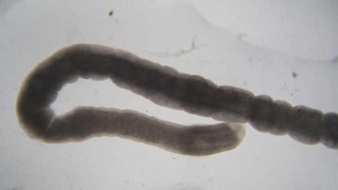 绦虫感染是一种寄生扁虫在消化道的侵扰，在显微镜下称为绦虫，用于实验室教育。