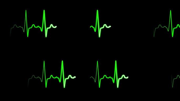 医学屏幕上的心律绿色图
