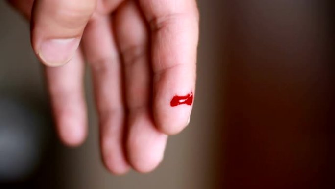 血液从男人小指的伤口上流出特写。休闲背景上的小指剪裁
