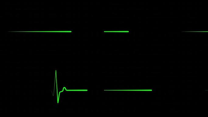 绿线心脏跳动的冲动。
