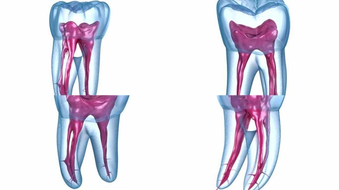 牙根解剖-第一上颌磨牙。医学上精确的牙科3D动画