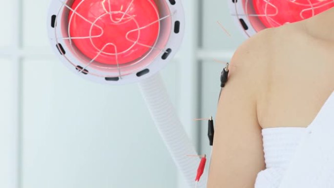 电针。中医针灸和电针对病人身体的影响