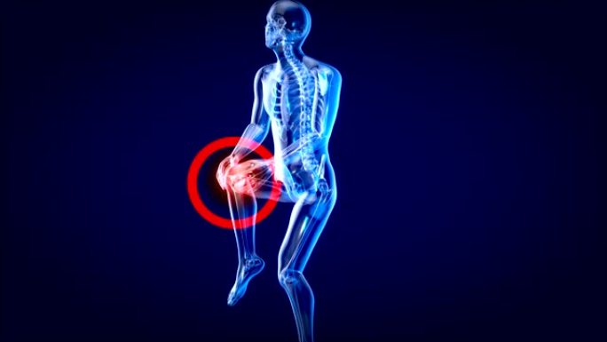 膝盖扭伤或疼痛导致疼痛运动设计