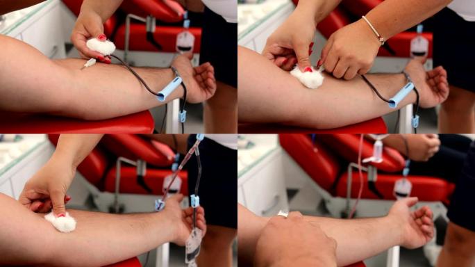 护士从捐献者手中取出医用针头。善行。为身体献血的好处。接受输血的接受者的手。在医疗诊所献血的特写
