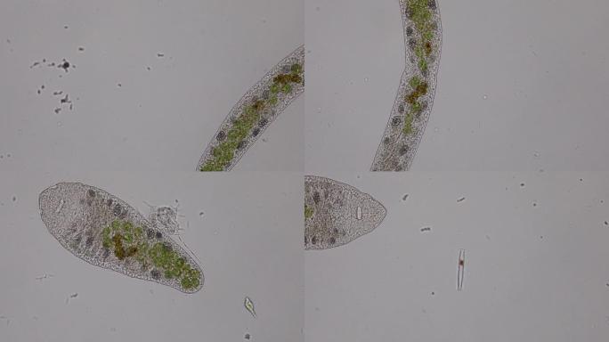 显微镜下废水中的原生动物寄生虫、细菌和藻类。