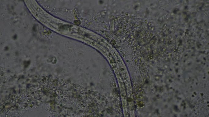 大线虫幼虫粪便检查。人类寄生虫。