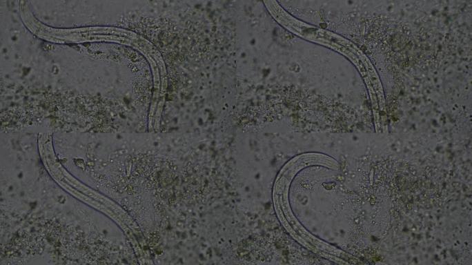 大线虫幼虫粪便检查。人类寄生虫。