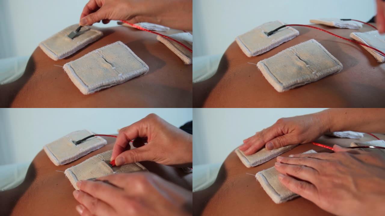 反射治疗师将电极固定在患者的背部进行电刺激。特写