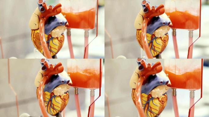 临床中心脏功能机器人模型的临床试验研究