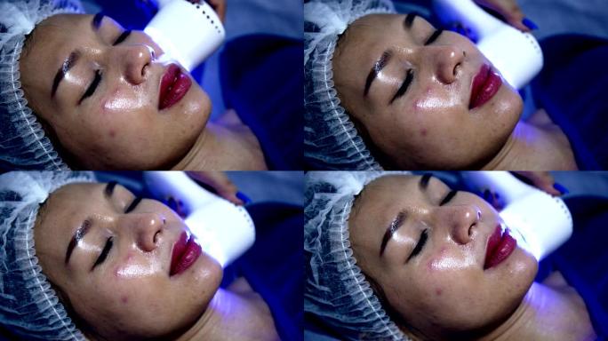女人用硬件美容的新激光技术做服务，年轻女人脸上有激光