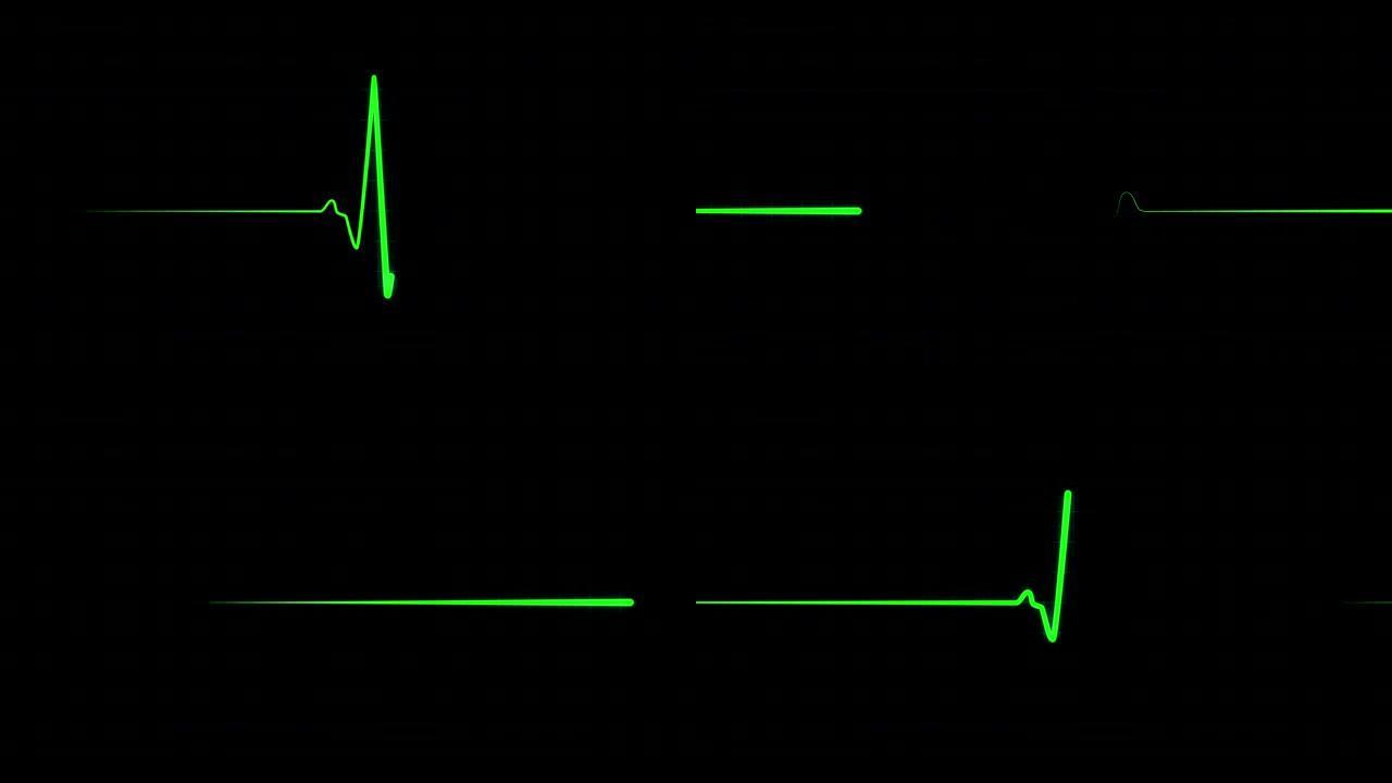EKG上的绿色心跳线，带有网格背景的ECG屏幕