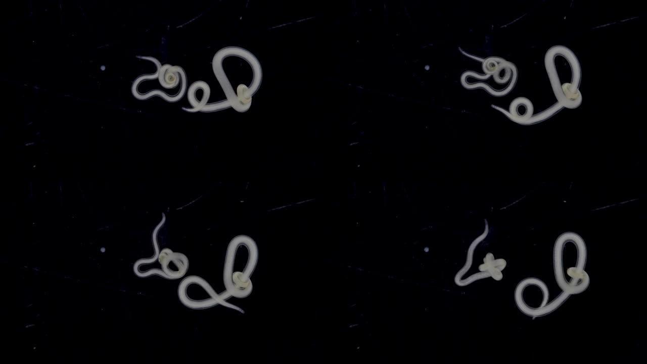 研究线虫门的蛔虫线虫，它是螃蟹中最常见的寄生虫，用于实验室测试。
