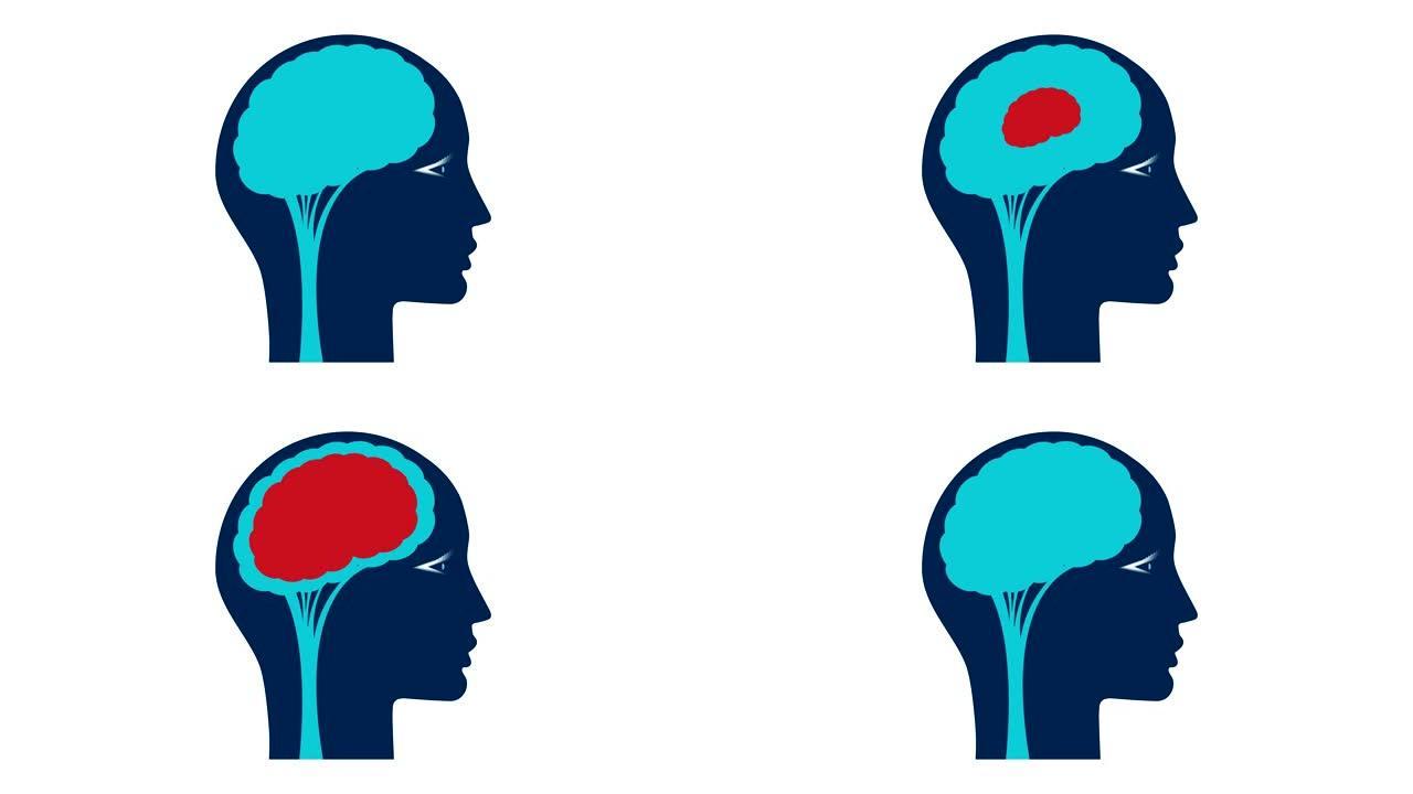 人脑。人脑中的信号传输动画，例如严重的疼痛或思想。