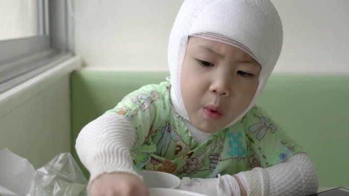 小女孩吃零食生病了。亚洲女婴患特应性皮炎。手持镜头，真实生活