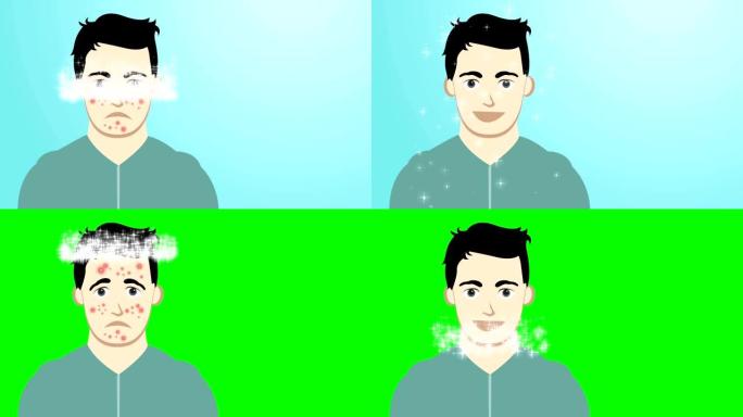 图文2d动画男脸前有、无粉刺后蓝绿屏背景对比效果